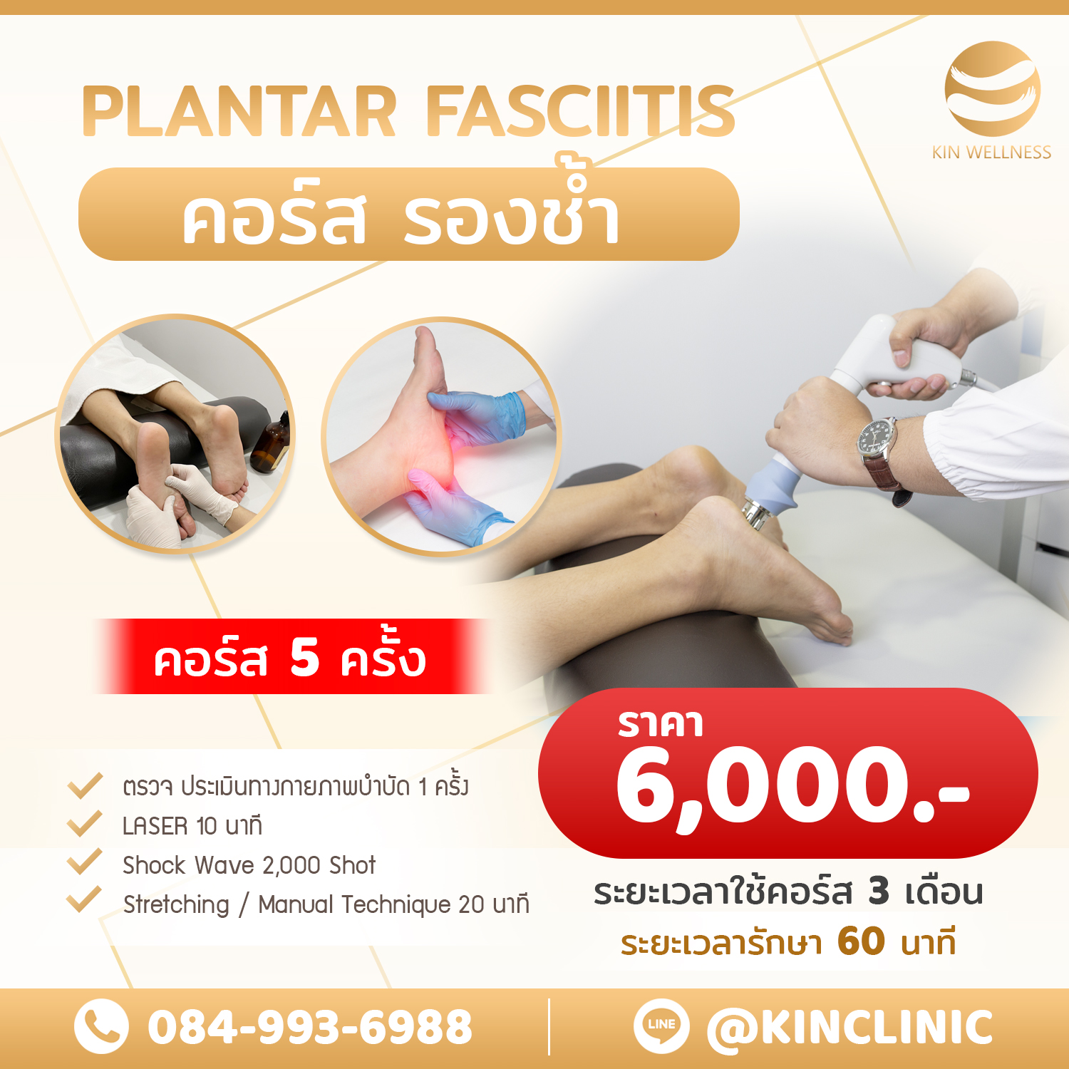 รองช้ำ Plantar Fasciitis รักษาด้วย Shockwave KIN Wellness